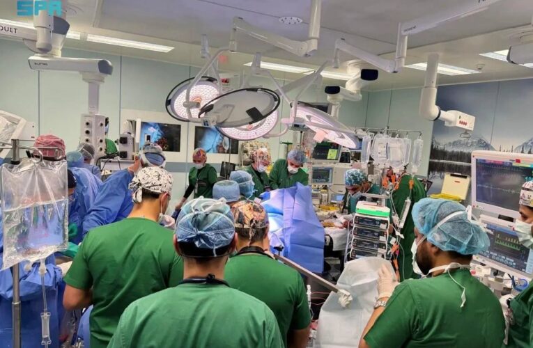 السعودية تنجح في فصل توأم فلبيني ملتصق بعملية معقدة استمرت أكثر من 18 ساعة