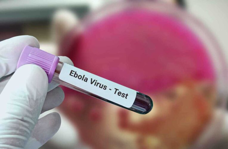 الصحة العالمية ترحب بأول حالات التعافي من سلالة إيبولا النادرة في الكونغو الديمقراطية