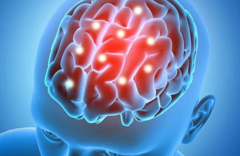 الخلايا الجذعية تفتح باباً جديداً لعلاج السكتة الدماغية واستعادة وظائف الدماغ