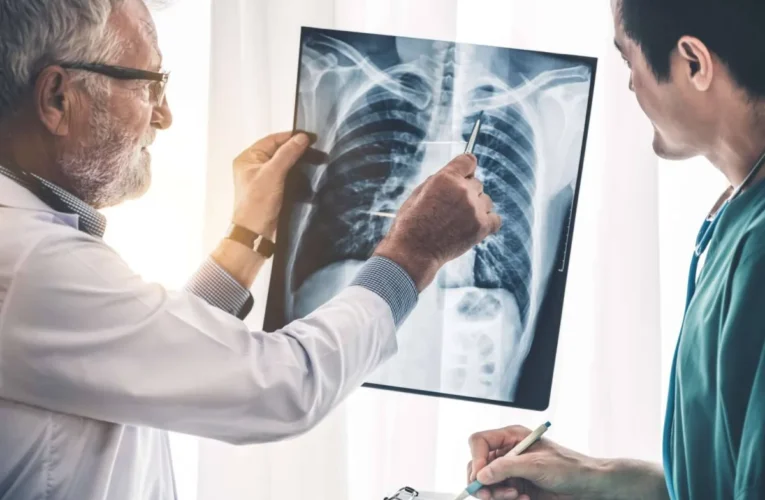 عقار تجريبي يستهدف طفرات السرطان يحقق نتائج واعدة لدى مرضى سرطان الرئة